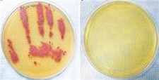 Two petri dishes, one with a red handprint
