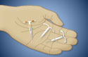 Hand holding hormonal intrauterine contraception