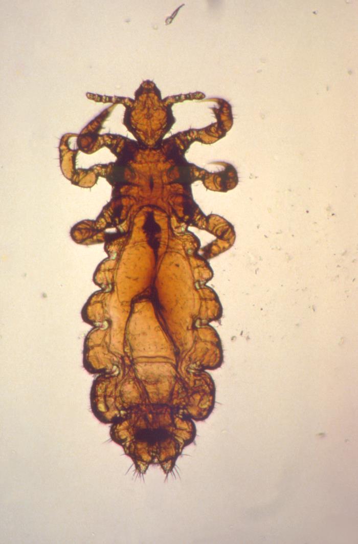 Microscope view of a single louse