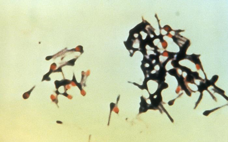 tetanus bacteria